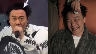 Eason Chan Gets Very Painful-Looking Bump On Forehead After Injuring Himself During Concert; Continues Performing