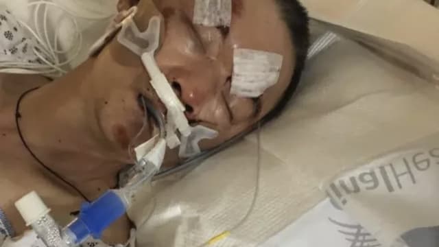 61岁华裔美国纽约街头遭殴仍昏迷