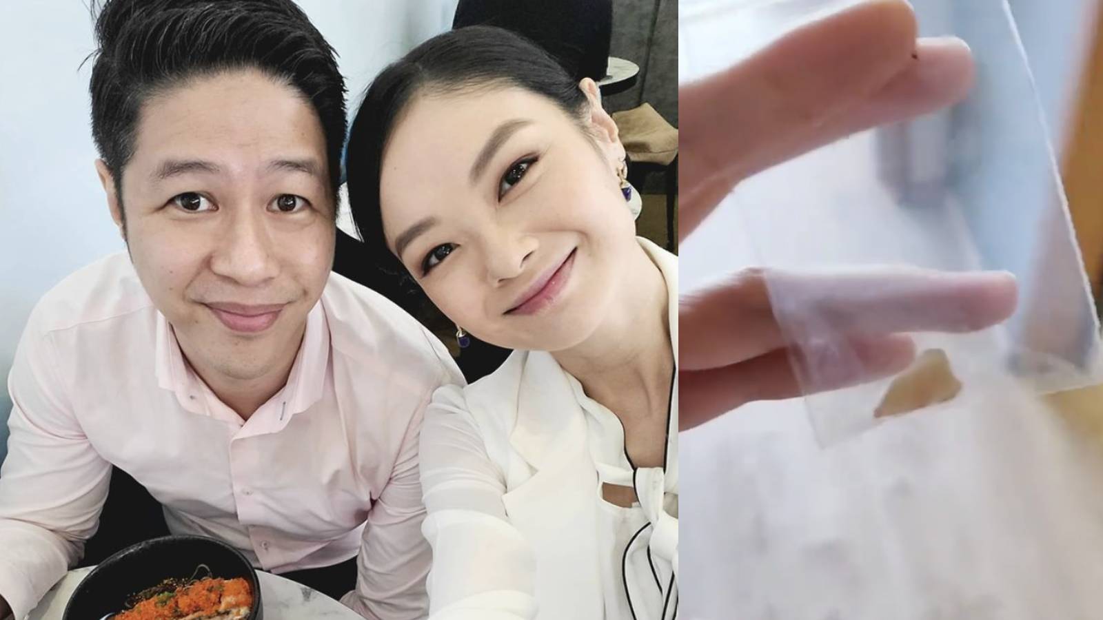 Sheila Sim Gave Her Husband Her Wisdom Tooth As A Present Sheila Sim Gave Her Husband Her Wisdom Tooth As A Present
