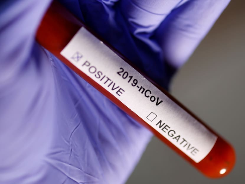 A new study found that a rapid coronavirus test touted by US President Donald Trump produces false negatives in almost half of all cases. A new study found that a rapid coronavirus test touted by US President Donald Trump produces false negatives in almost half of all cases.