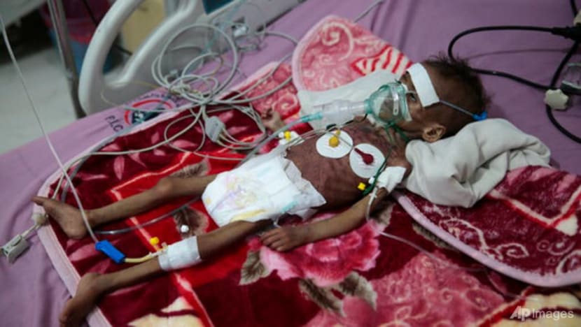 UN warns COVID-19 is `roaring back' as Yemen faces famine