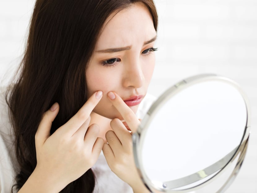 Squeezing that pimple may cause scabbing, post-inflammatory hyperpigmentation or tissue loss that results in pitted acne scars. Photo: Shutterstock Squeezing that pimple may cause scabbing, post-inflammatory hyperpigmentation or tissue loss that results in pitted acne scars. Photo: Shutterstock