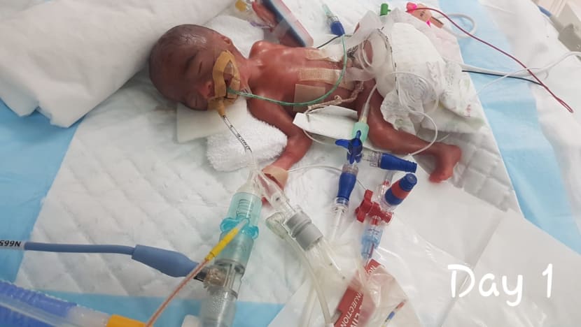 1 kg premature sales baby