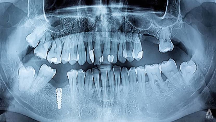 Brushing Up On Alzheimer’s Link to Gum Disease Brushing Up On Alzheimer’s Link to Gum Disease