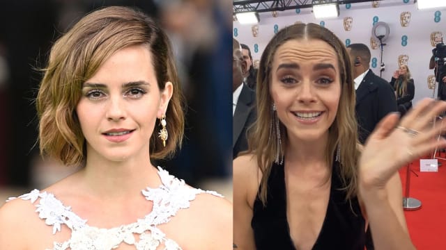 双颊凹陷、满脸皱纹　Emma Watson红毯造型被指显老