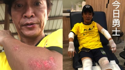 Jacky Wu Crashes Bike While Filming Variety Show; Says His Helmet Was "Completely Shattered"