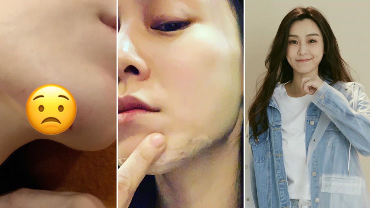 Christine Fan Split Her Chin Open After Falling Down At Home And The Pics Are Too Much