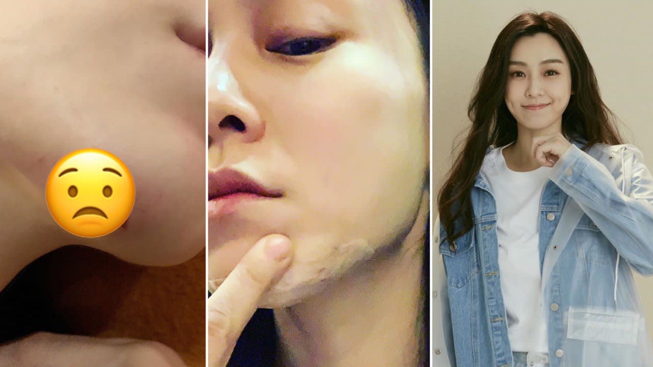 Christine Fan Split Her Chin Open After Falling Down At Home And The Pics Are Too Much Christine Fan Split Her Chin Open After Falling Down At Home And The Pics Are Too Much