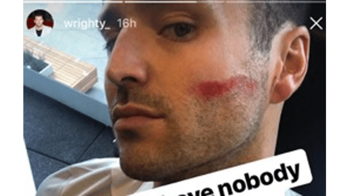 Mark Wright injured at the gym 8 Days
