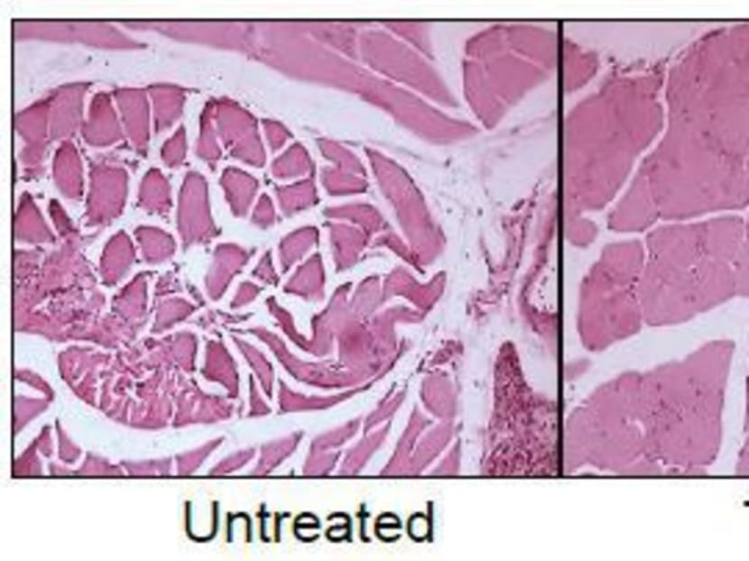 Treatment of muscles during cancer cachexia. Photo: A*STAR, Duke-NUS, NCCS
