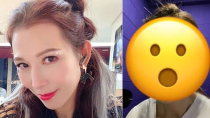Ada Choi’s Facial Acupuncture Session Is Weirdly Cool… Yet Creepy
