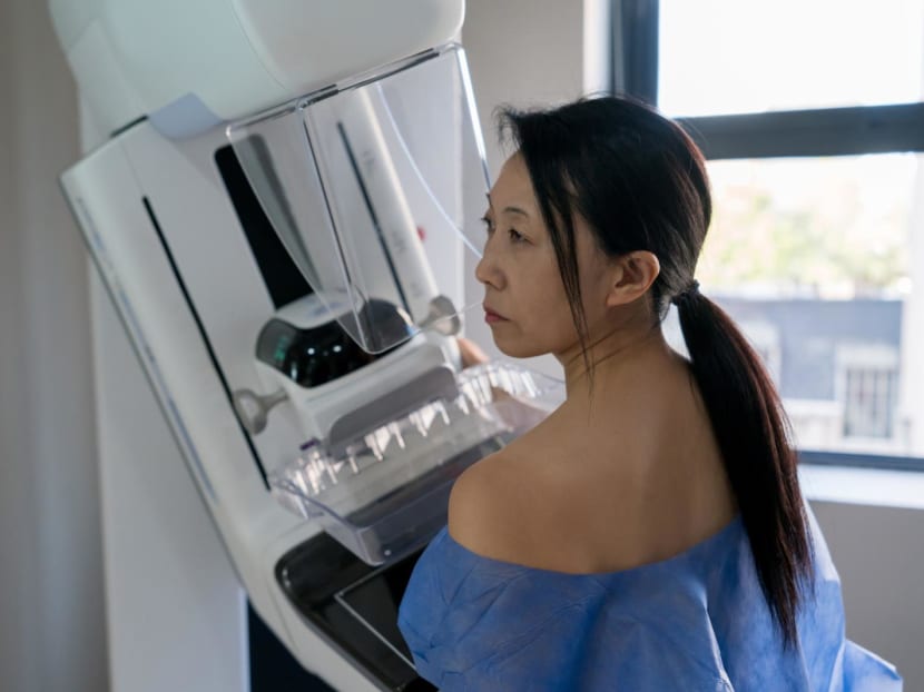 Breast lumps, mammograms, mastectomy: 13 questions about breast cancer from Singapore women aged 20 to 70