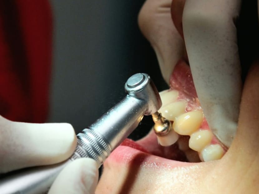 Commentary: Tooth whitening – don’t gamble with your teeth Commentary: Tooth whitening – don’t gamble with your teeth