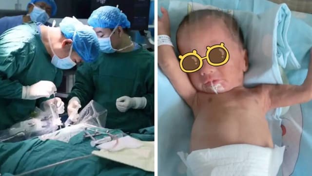 头颅仅8厘米！中国医院以机器人成功为早产儿做脑手术