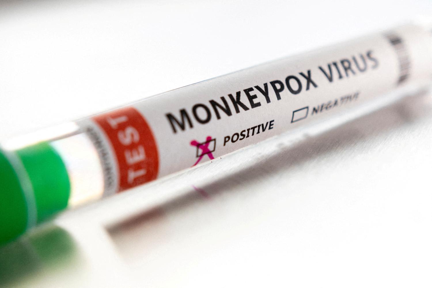 South Korea has designated monkeypox as a second-degree infectious disease, according to its four-tier system, with 22 contagious diseases including Covid-19, cholera and chickenpox being included in the same category. South Korea has designated monkeypox as a second-degree infectious disease, according to its four-tier system, with 22 contagious diseases including Covid-19, cholera and chickenpox being included in the same category.