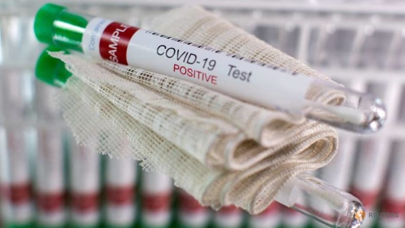 Nine British athletes test positive for COVID-19 - Times Nine British athletes test positive for COVID-19 - Times