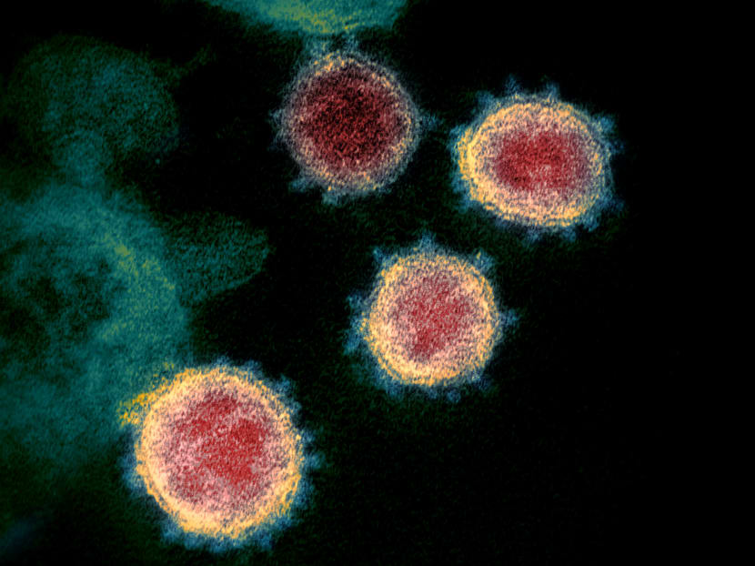 A transmission electron microscope image shows SARS-CoV-2, also known as novel coronavirus, isolated from a patient in the US.
