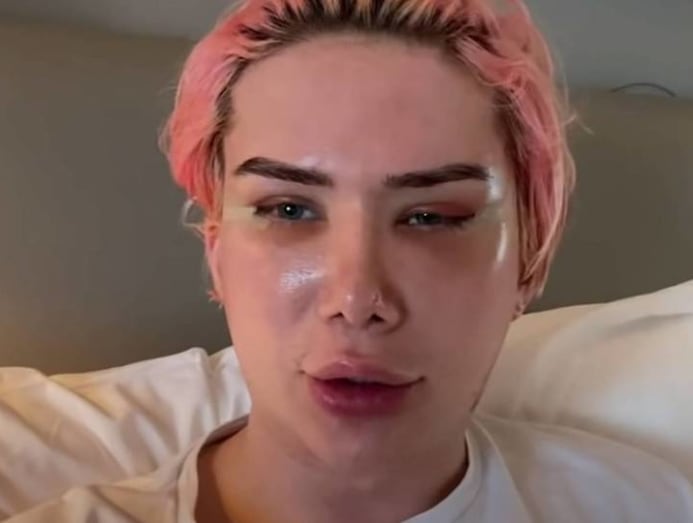 British Influencer Identifies As Korean Gets Surgery To Look Like Bts Jimin Cna Lifestyle British Influencer Identifies As Korean Gets Surgery To Look Like Bts Jimin Cna Lifestyle