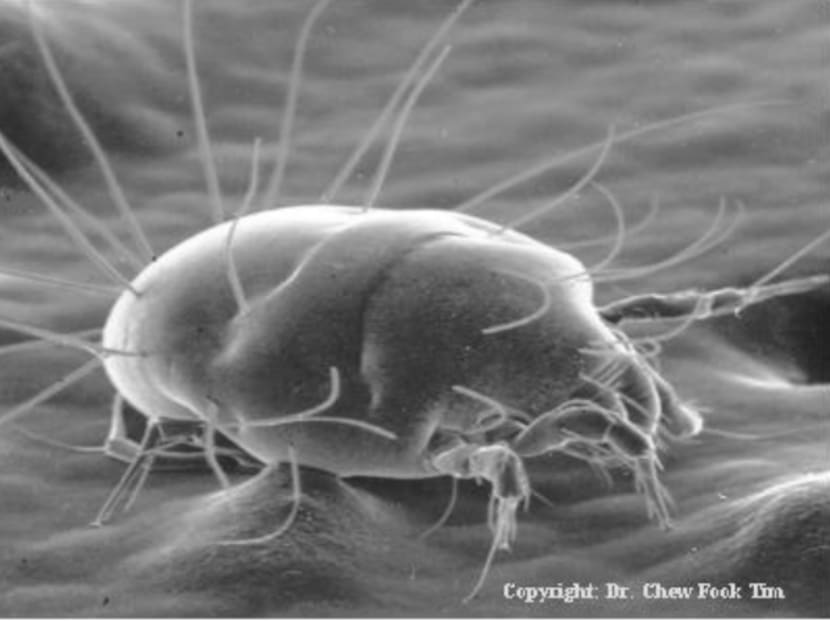 Dust mites the culprit behind allergies in S’pore: Study