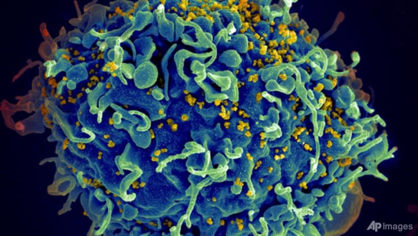 UN urges action to end AIDS, saying COVID-19 hurt progress