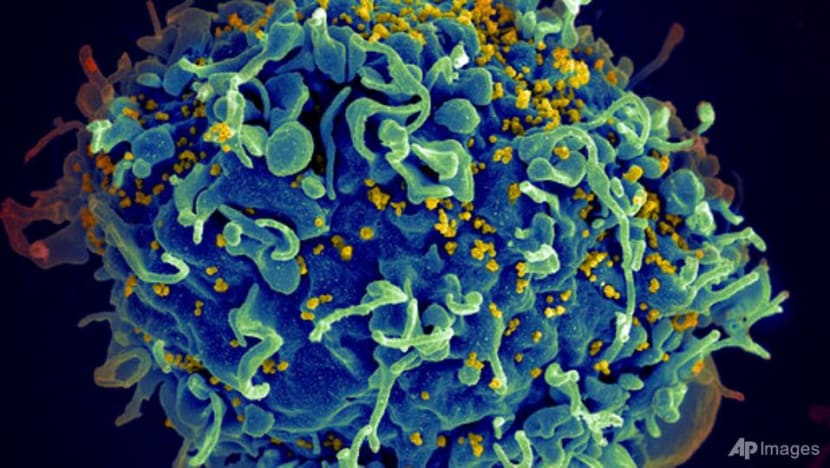 UN urges action to end AIDS, saying COVID-19 hurt progress UN urges action to end AIDS, saying COVID-19 hurt progress