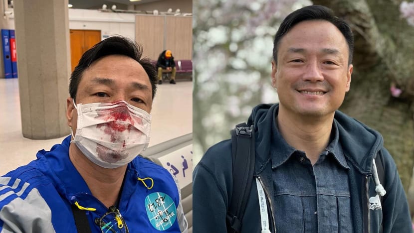 HK Actor Wong Hei Suffers Horrifying Nosebleed After Getting “Stabbed” In The Nose By Staff Administering His PCR Test At Taiwan Airport