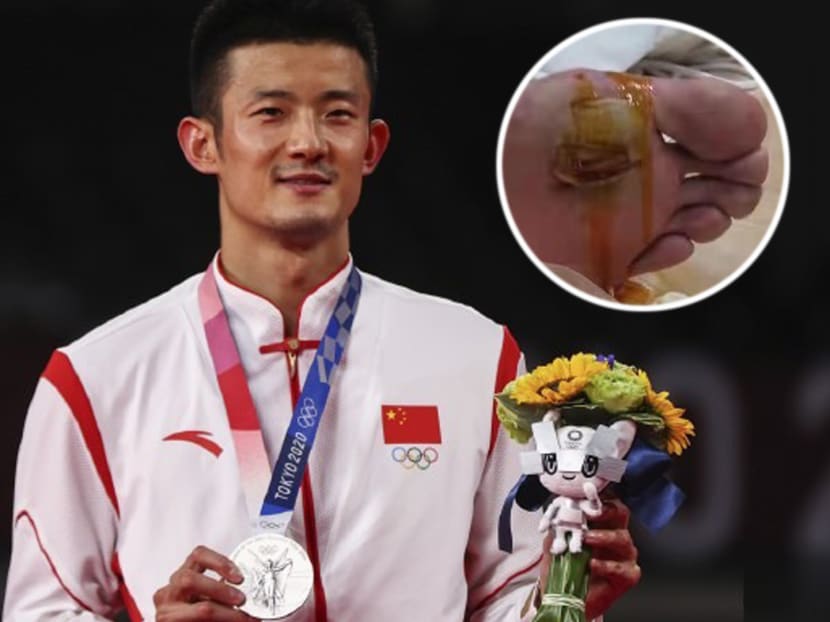 endelse Invitere bund Chinese Olympic Shuttler Chen Long Was Called “Useless” For Not Winning  Badminton Gold; Coach Reveals How Badly Blistered His Feet Were During  Match - TODAY