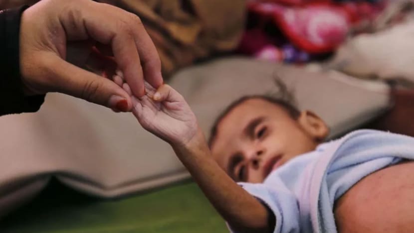 Sekurang-kurang 400,000 kanak-kanak Yaman berisiko mati akibat kebuluran