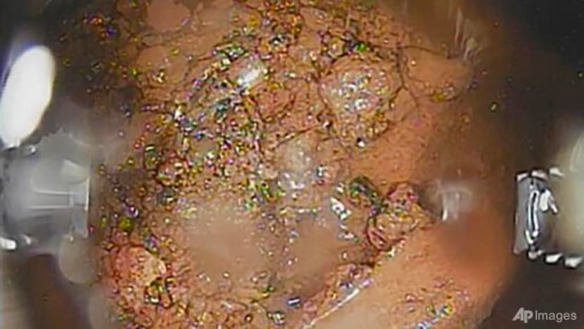 Melted fuel removal at Fukushima delayed by pandemic Melted fuel removal at Fukushima delayed by pandemic