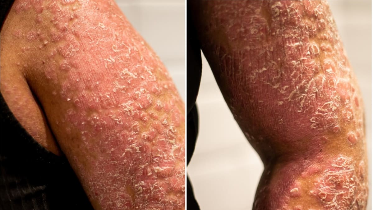 Skin diseases hotsell