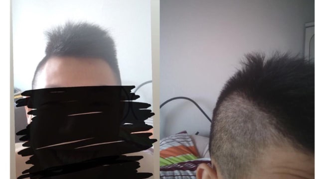 男子理发后发现发型不对称 理发师称“头发会长回来”