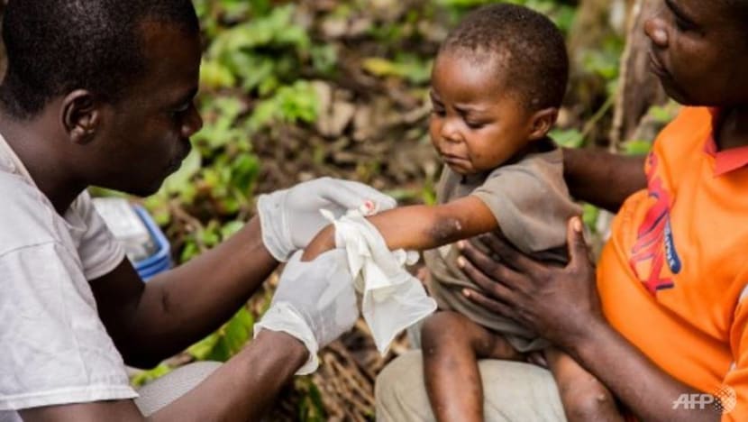 Commentary: Vigilance, not universal smallpox vaccination, needed against monkeypox Commentary: Vigilance, not universal smallpox vaccination, needed against monkeypox