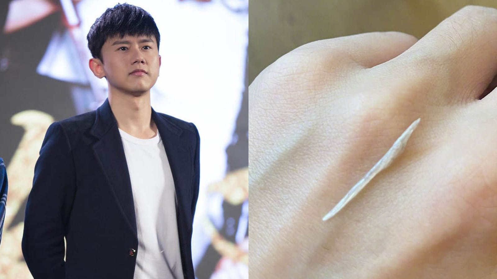 Chinese Singer Zhang Jie Rushed To The Hospital After Swallowing Fish Bone; Has A Fear Of Eating Fish Now Chinese Singer Zhang Jie Rushed To The Hospital After Swallowing Fish Bone; Has A Fear Of Eating Fish Now
