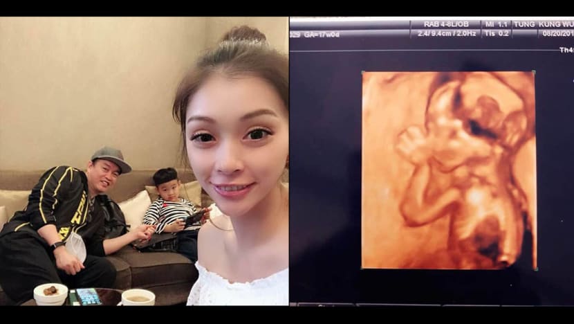 Taiwanese comedian Kang Kang and wife expecting a baby girl