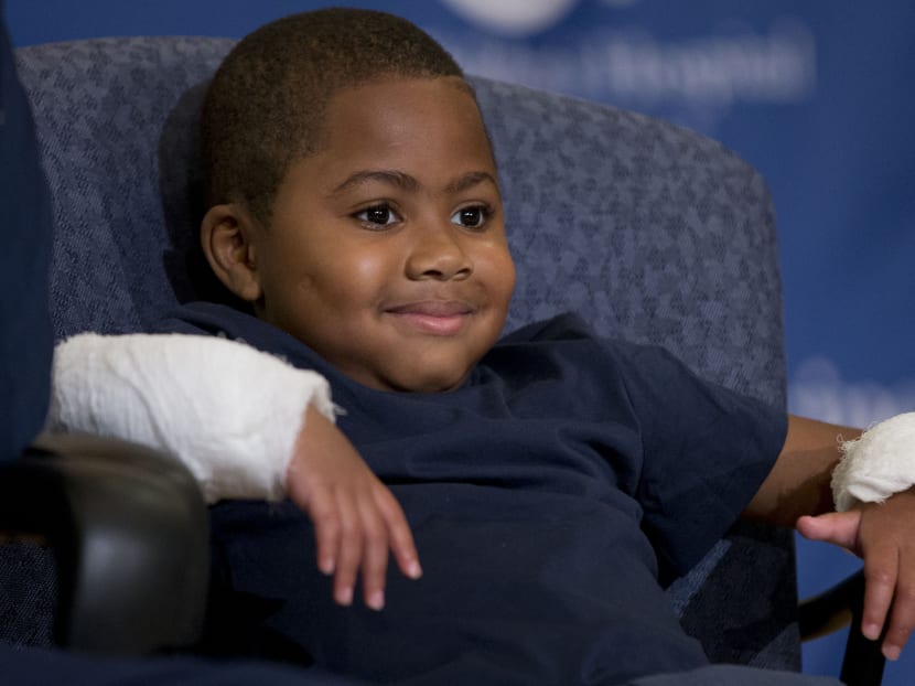 Gallery: Boy who lost hands to infection gets double-hand transplant