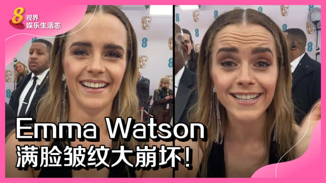 Emma Watson满脸皱纹大崩坏！