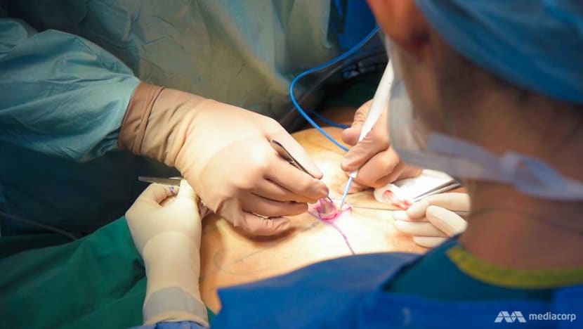 MOH says 'stern action' for doctors who perform liposuction without accreditation, doctor urges tighter guidelines MOH says 'stern action' for doctors who perform liposuction without accreditation, doctor urges tighter guidelines