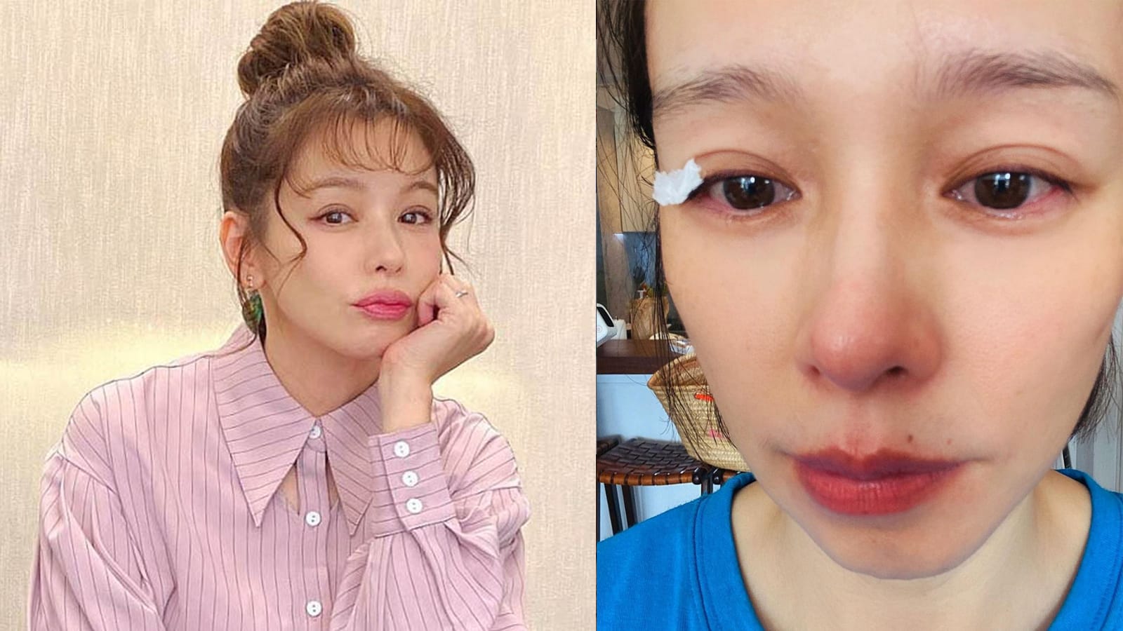 Vivian Hsu Thought She Had Nose Cancer After Looking Up Her Symptoms Online Vivian Hsu Thought She Had Nose Cancer After Looking Up Her Symptoms Online