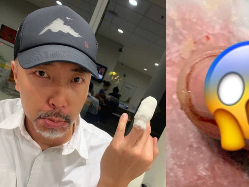 Tay Ping Hui Crushed His Finger Real Badly On Set; Says The Pain Was A “Perfect 10” Tay Ping Hui Crushed His Finger Real Badly On Set; Says The Pain Was A “Perfect 10”