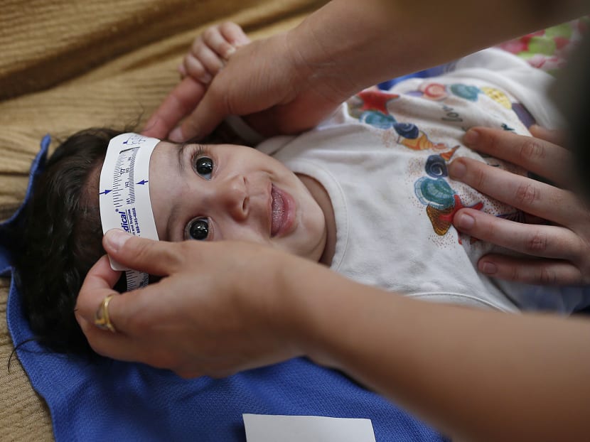 Three-month-old Esther Kamilly has her head measured by Brazilian and U.S. health workers from the United States' Centers for Disease Control and Prevention (CDC) at her home in Joao Pessoa, Brazil, Wednesday, Feb. 24, 2016, as part of a study to determine if the Zika virus is causing babies to be born with a birth defect affecting the brain. Photo: AP