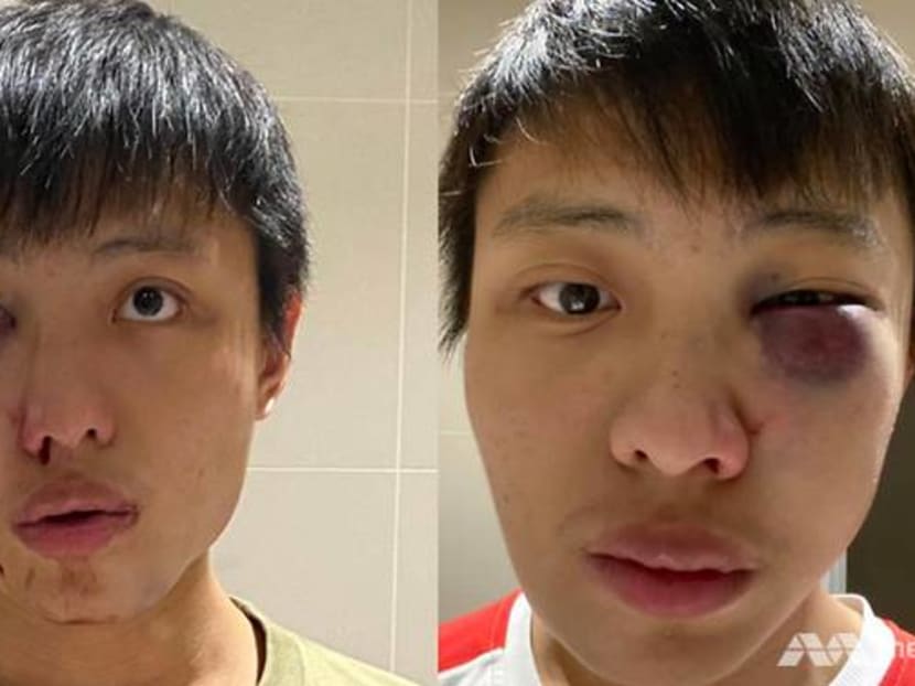 Mr Jonathan Mok uploaded photos of his bruised face on Facebook. Mr Jonathan Mok uploaded photos of his bruised face on Facebook.