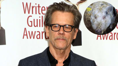 Kevin Bacon Makes An Appeal To Find Namesake Scottish Pig A New Home