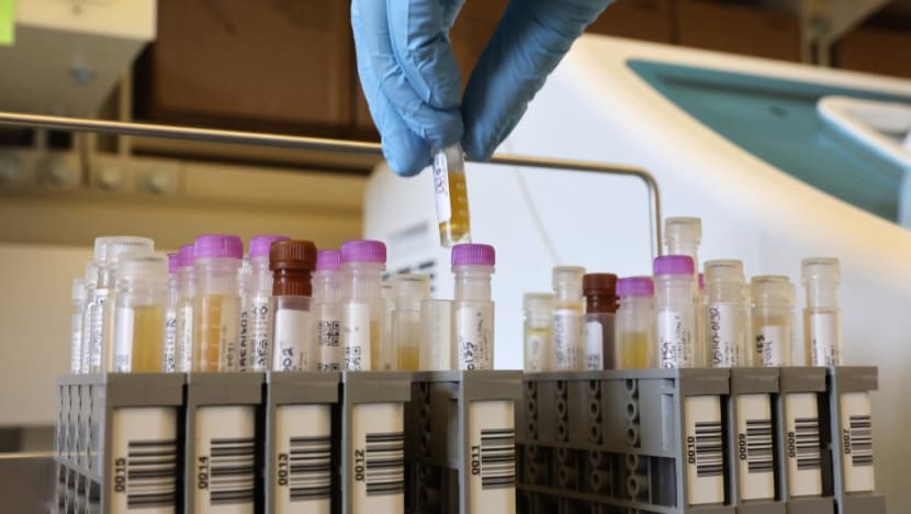 FAQ: What you need to know about Novavax's non-mRNA COVID-19 vaccine Nuvaxovid FAQ: What you need to know about Novavax's non-mRNA COVID-19 vaccine Nuvaxovid