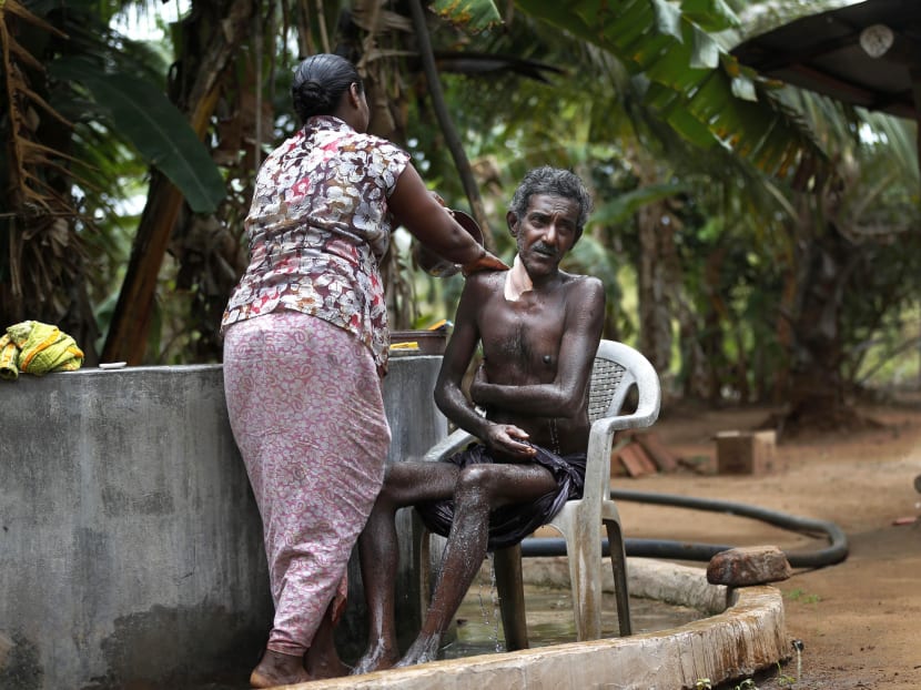 In this July 16, 2013 photo, Kumaradasa, a Sri Lankan farmer suffering from a deadly mystery kidney disease, bathes with the help of his wife outside their house in Medavachchiya, Sri Lanka. Photo: AP