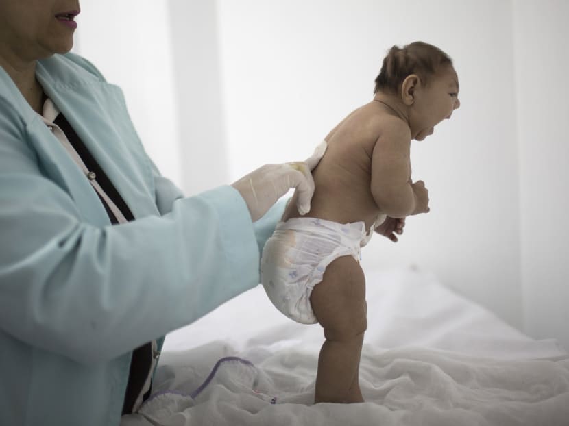 Lara, who is less then 3-months old and was born with microcephaly, is examined by a neurologist at the Pedro I hospital in Campina Grande, Paraiba state, Brazil. Photo: AP