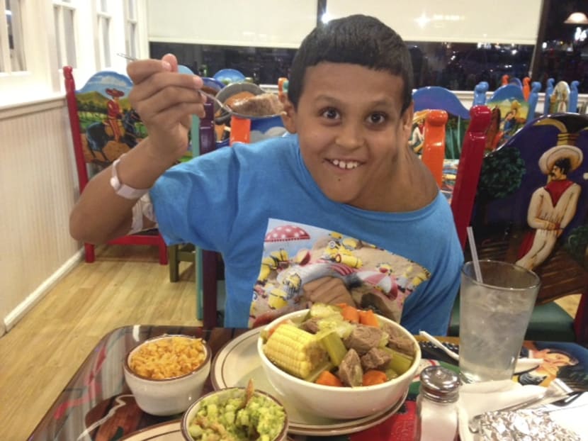 Mexican boy has massive tumour removed in US
