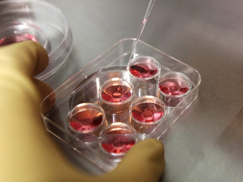 An employee demonstrates the process to extract eggs at a fertility clinic in northern Taiwan. An employee demonstrates the process to extract eggs at a fertility clinic in northern Taiwan.