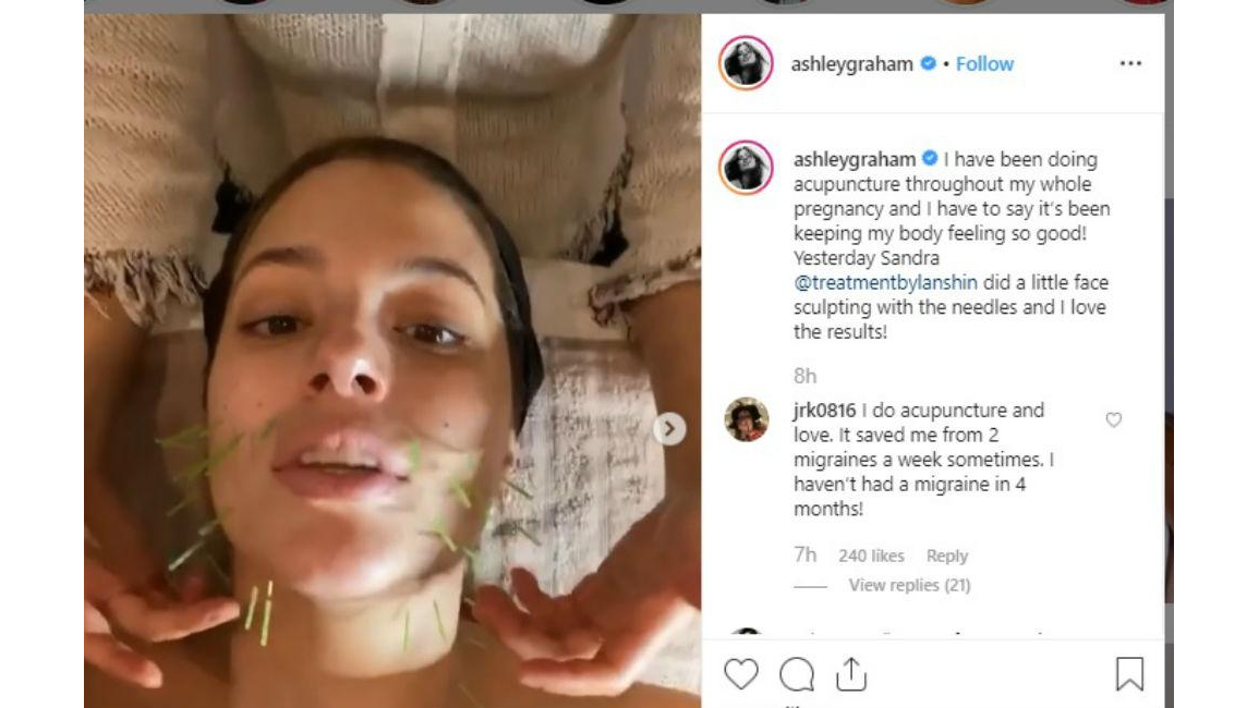 Ashley Graham Has Facial Acupuncture 8days 0180