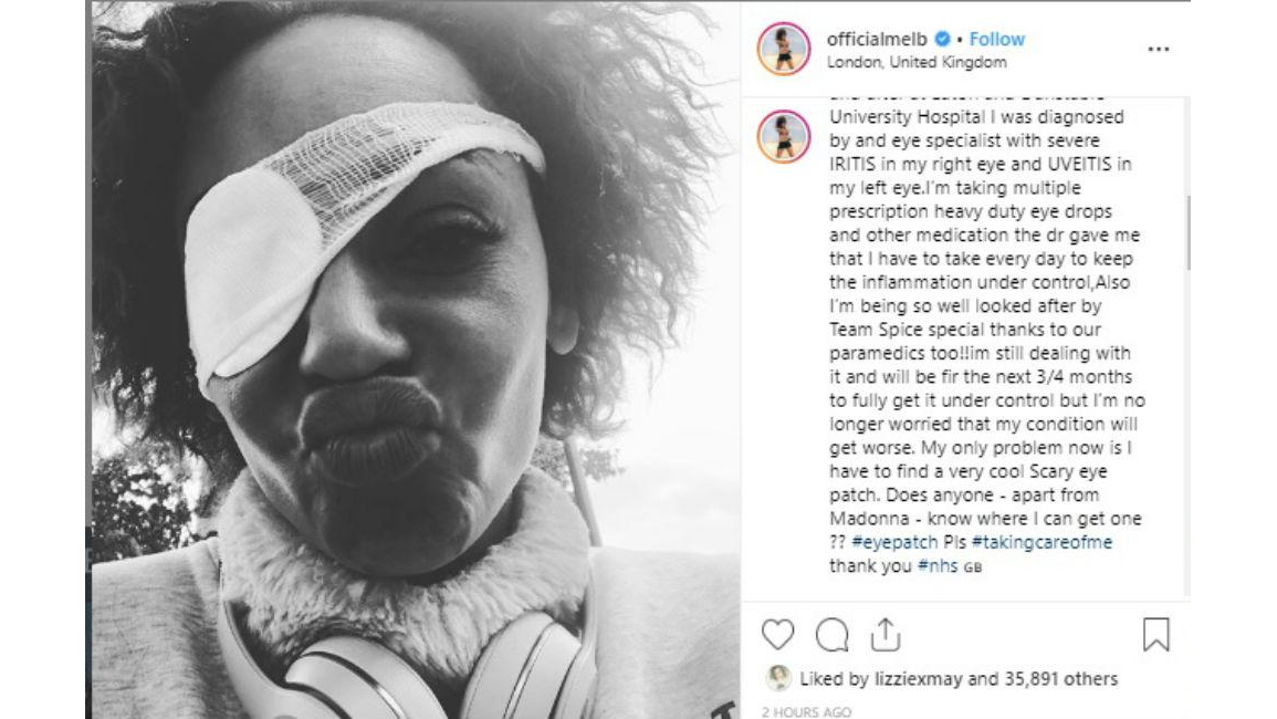 Mel B Was Very Very Scared Over Vision Loss 8days