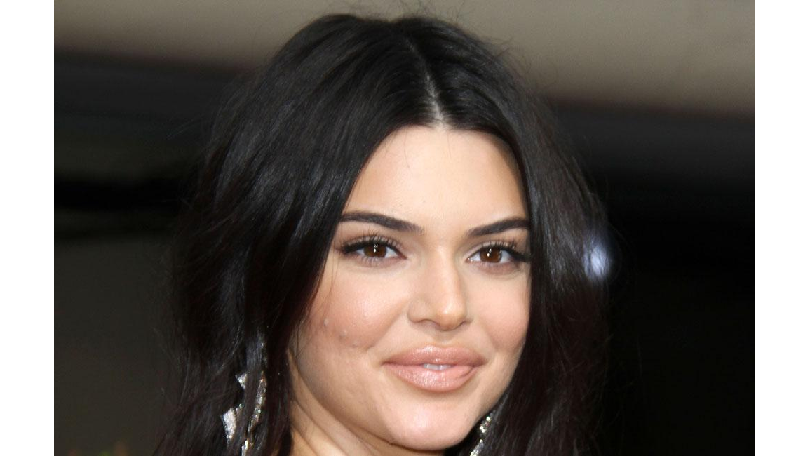 Kendall Jenner relieves acne agony 8days